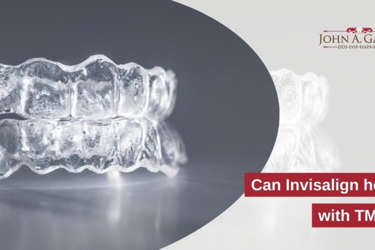 Can Invisalign Help with TMJ?